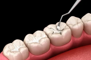 دندان پزشکی دنتریتا دکتر علی رفعتی